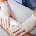 The Power of Proper Wound Dressing for Optimal Healing