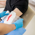 Best Practices For Treating Excoriation Wound Vs Maceration Wound In Emergencies