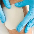 The Art of Wound Dressing: A Nurse's Guide to Optimal Care