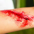 Wound Infection Symptoms and Emergency Care Tips for Fast Recovery