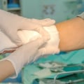 The Impact of Proper Wound Dressing on Patient Outcomes