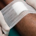 The Truth About Wound Care: To Cover or Not to Cover?