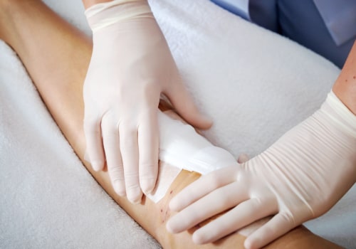 The Power of Proper Wound Dressing for Optimal Healing