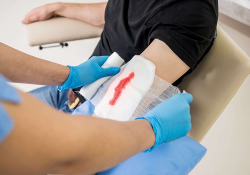 Best Practices For Treating Excoriation Wound Vs Maceration Wound In Emergencies