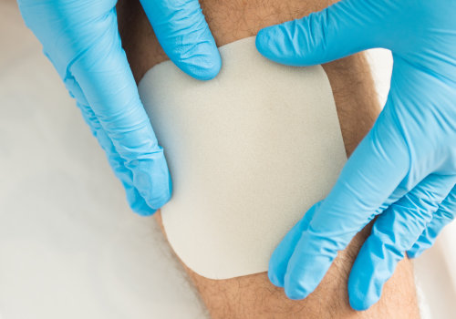 The Ultimate Guide to Wound Dressing: Expert Tips and Techniques