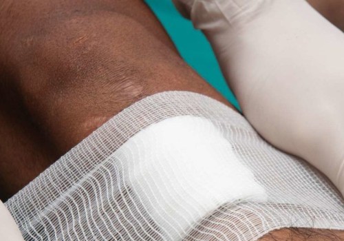 The Truth About Wound Care: To Cover or Not to Cover?